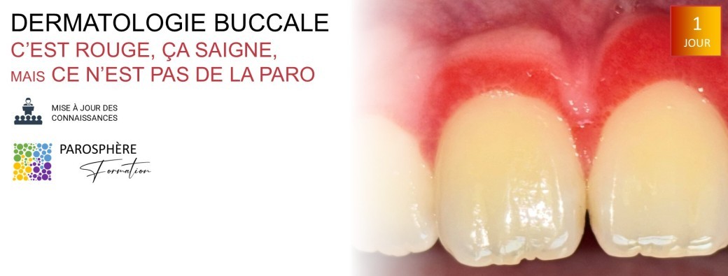 Dermatologie buccale