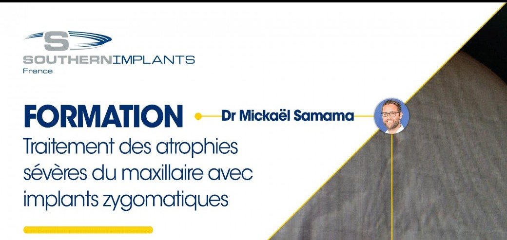 FORMATION - Traitement des atrophies sévères du maxillaire avec des implants zygomatiques