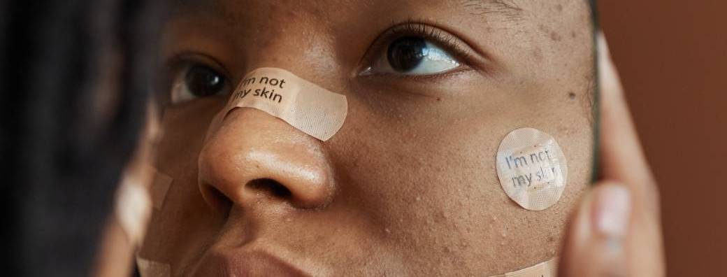 Groupe de parole "Vivre avec la dermatillomanie" Groupe de parole "Vivre avec la dermatillomanie"