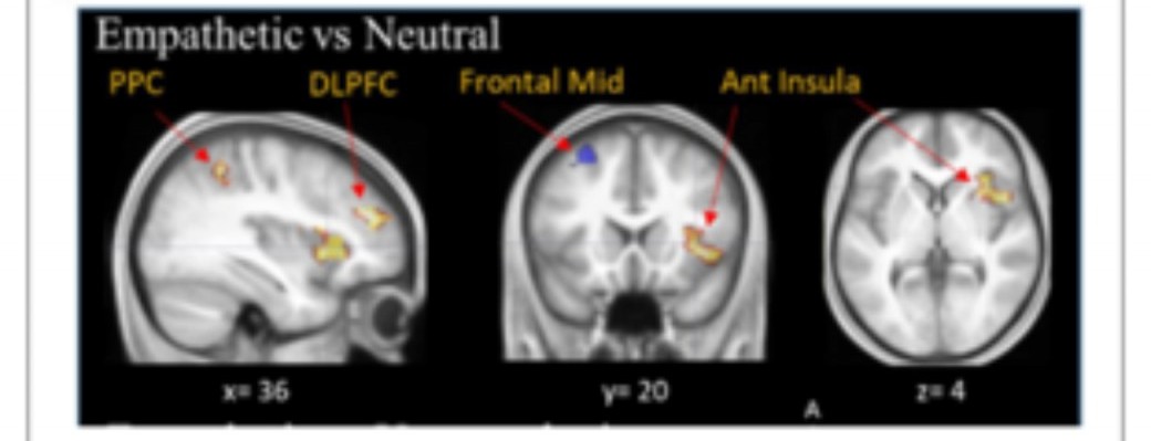 L’effet placebo : le point de vue des neurosciences