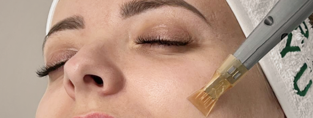 Masterclass NOTOX pour les professionnels de l'esthétique médical