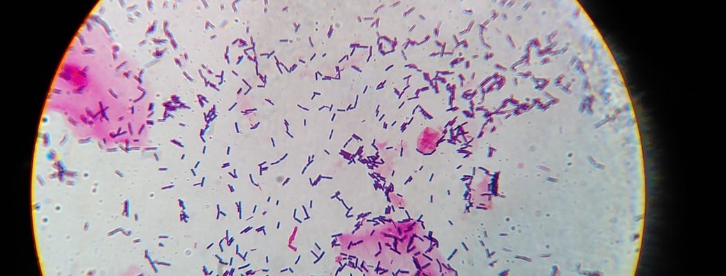 Mate ton Microbiote : ta flore vaginale au microscope ! 