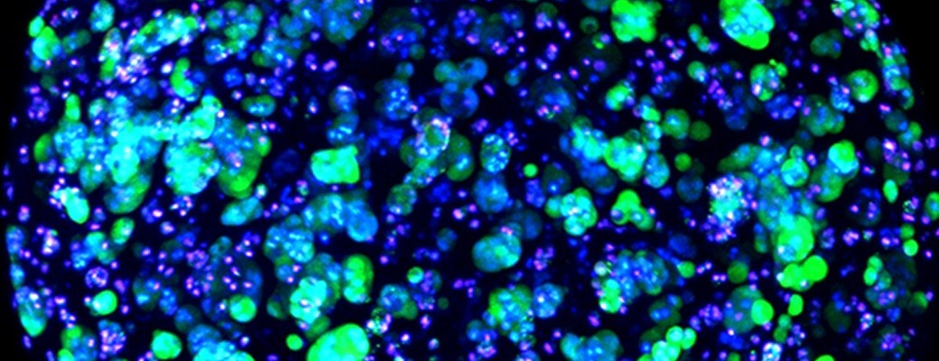 Comment reconstruire ou réparer un foie ?  Comment reconstruire ou réparer un foie ?