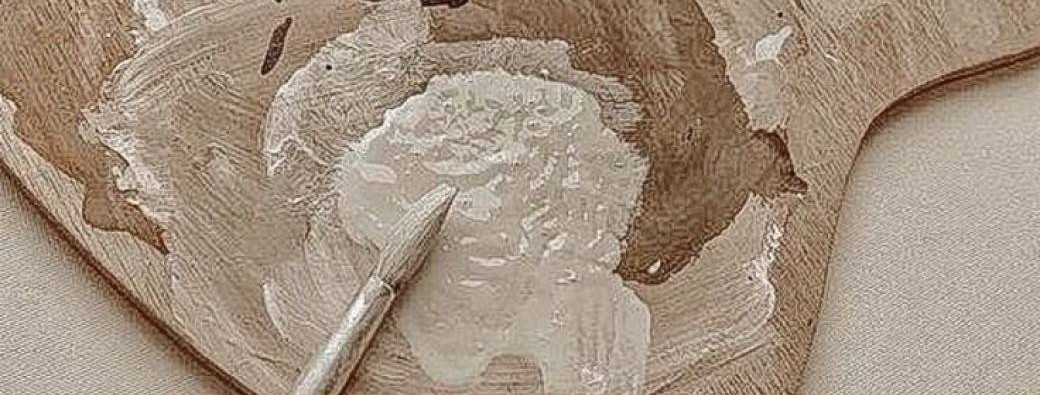 Session Art Thérapie 